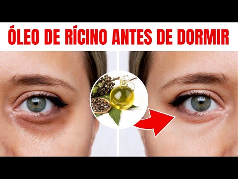 Isso Acontece Quando Você Usa Óleo de Rícino Antes de Dormir