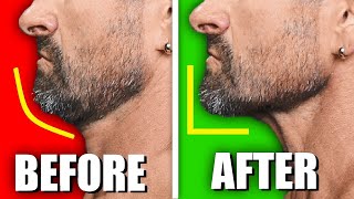 Do THIS to Get a STRONGER Jawline &  CHISELED Face (IN 10 DAYS)!