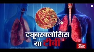 Ayushman Bhava : Tuberculosis (TB) | तपेदिक screenshot 2