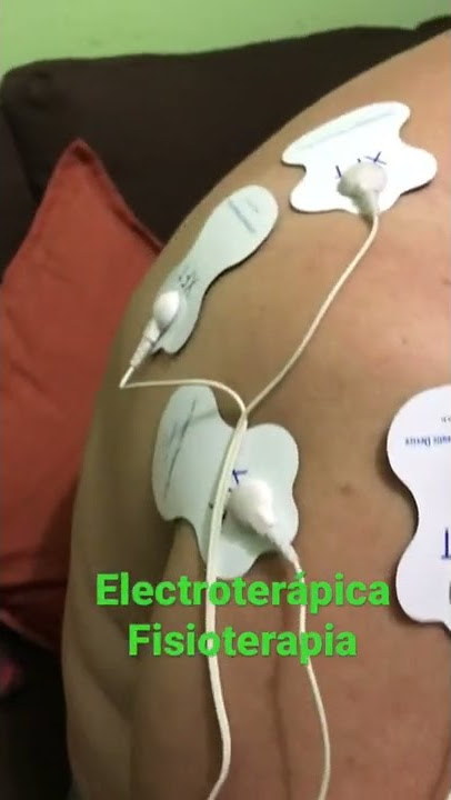 Beneficios de la electroestimulación del recto abdominal - Blog de  fisioterapia