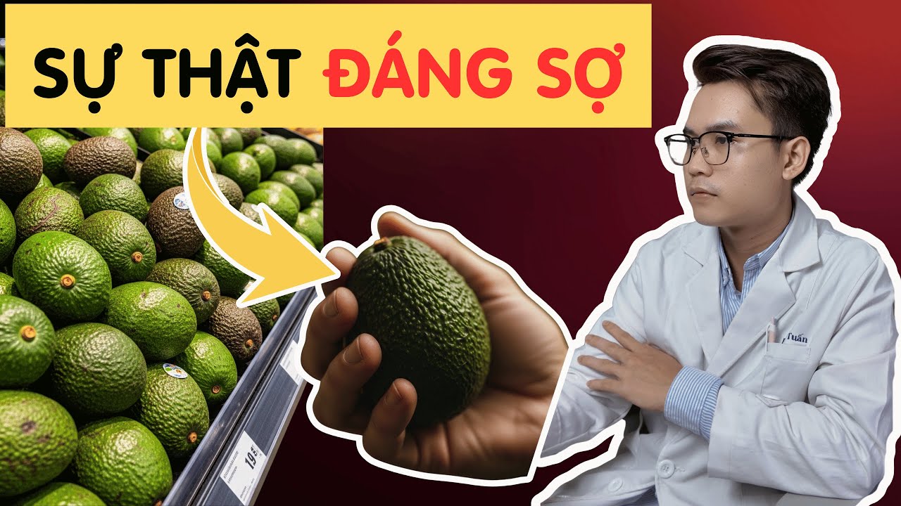 Quả Bơ - Nguy Hiểm Ẩn Sau Những Lợi Ích Mà Bạn Chưa Biết | Bác Sĩ Tuấn