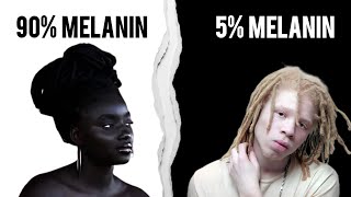 Black People Skin Tones Explained. 