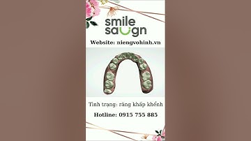 Phác đồ niềng răng khấp khểnh - Smilesalign Việt Nam
