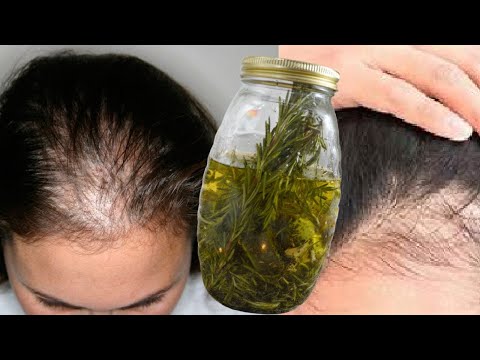 Vídeo: Tratamiento Anticaída: Mascarillas Y Remedios Caseros Eficaces Para La Caída Del Cabello