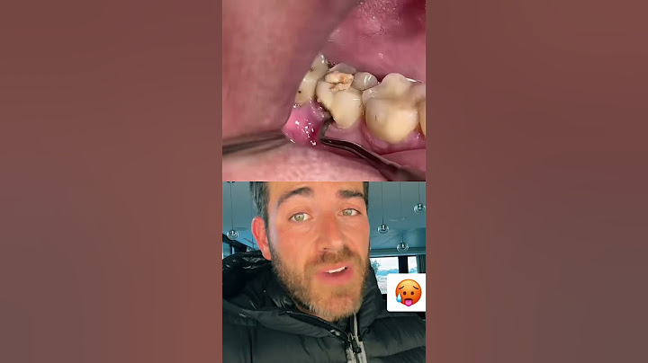 Il consulte parce qu’il a une mauvaise haleine et voilà ce qu’il trouve’🥵 #shorts