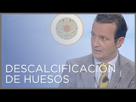 Video: ¿Cuál es el punto final de la descalcificación?