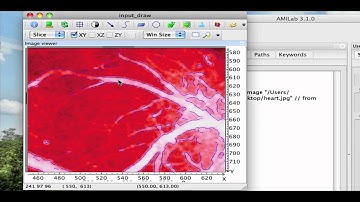 Subpixel edge detection