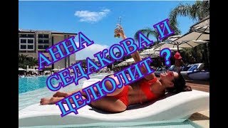 АННА СЕДОКОВА С ЦЕЛЮЛИТОМ, КАК ПУТИН С БОРОДОЙ. АННА СЕДОКОВА С ЦЕЛЮЛИТОМ, КАК ПУТИН С БОРОДОЙ.