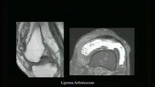 50   MRI Cases