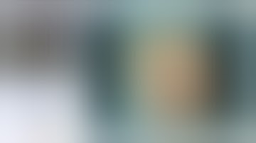 PCNL - PCNL in Ectopic Pelvic Kidneys