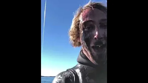 Octopus Ink to the Face