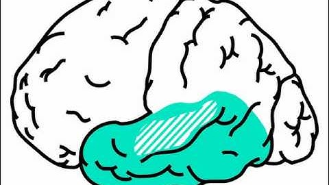 Neuro Exam ; Mental Status : Anatomy Temporal Lobes