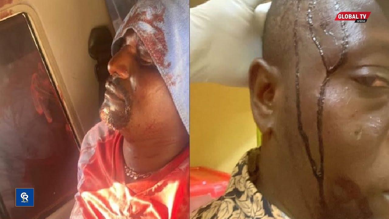 WAANDISHI wa HABARI WAVAMIWA na KUJERUHIWA kwa MIKUKI, SIME NGORONGORO, HALI ZAO MBAYA, DC AZUNGUMZA