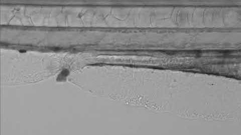 Live Zebrafish imaging- Blood flow