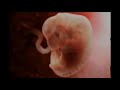 IVF Process &amp; Procedure of Baby Making