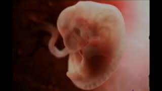 IVF Process &amp; Procedure of Baby Making