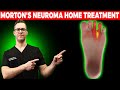 BEST Morton's Neuroma HOME Treatment [Shoes, Orthotics, Injections]!