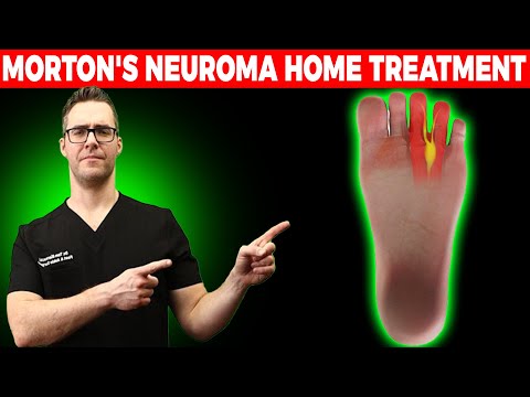 BEST Morton&rsquo;s Neuroma HOME Treatment [Shoes, Orthotics, Injections]!