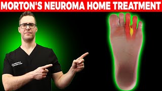 BEST Morton's Neuroma HOME Treatment [Shoes, Orthotics, Injections!]