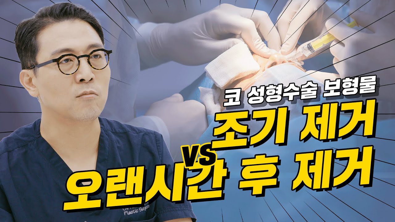 162화.  실리콘(코성형수술 보형물) 조기제거 vs 오랜시간 후 제거?