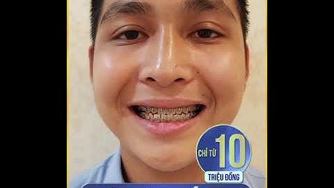 TẠM BIỆT NỖI ÁM ẢNH RĂNG THƯA, HÔ, MÓM, KHẤP KHỂNH