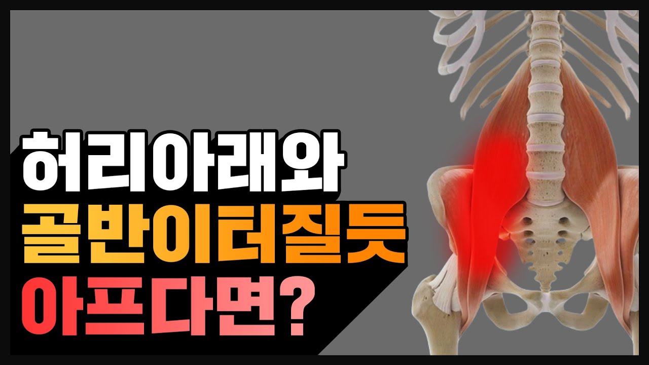 장요근 증후군,장요근을 한번이라도 스트레칭하신 분들은 반성하세요 / 해결방법!!!!