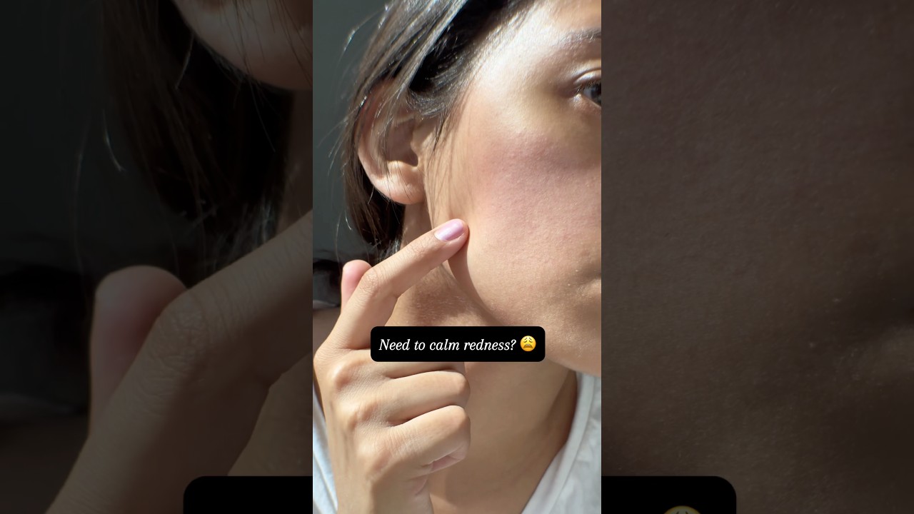 Need to calm redness? ‼️🚨