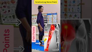 Sciatica(Leg Nerve Pain) Cure @ Home Guaranteed fitness sciaticapain nervepainrelief