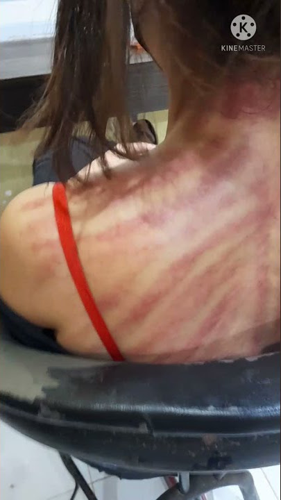 kerokan cewek cantik masuk angin