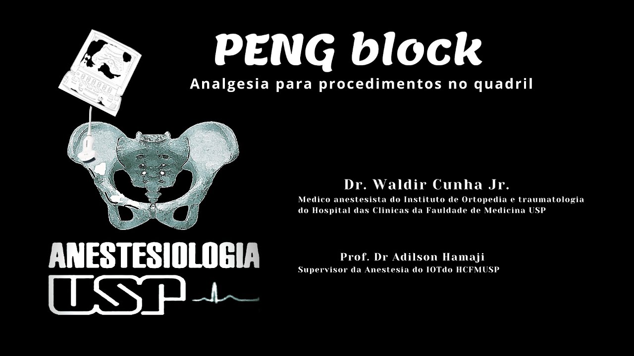 Peng Block Steps What Is A Peng Block – TOPO INTERNES: PENG Bloc et WALANT – XNNHNC