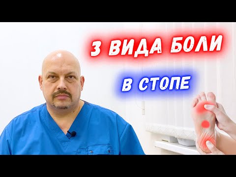 Видео: Где находится тыльная сторона стопы?