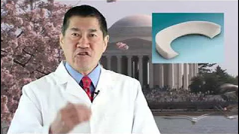 Arthritis | meniscus implants created by 3 D printing