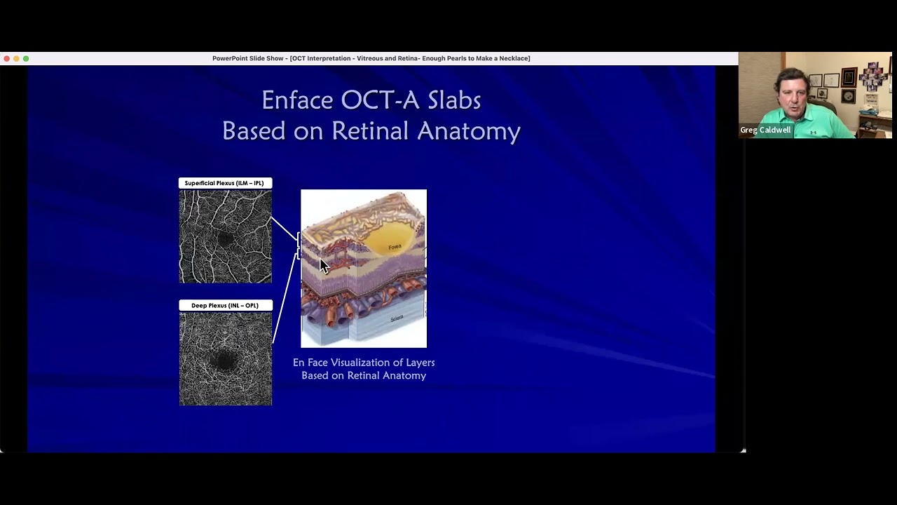 OCT Interpretation Vitreous and Retinal Enough Pearls to Make a ...
