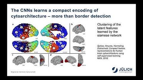 Timo Dickscheid - Towards automated mapping of cytoarchitectonic areas using Deep Learning