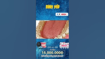 [3D] RĂNG YẾU || Nha Khoa Quốc Tế Athena