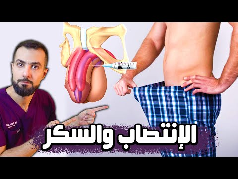 فيديو: كيفية تقبيل الرجل حتى يحبها ولا يهرب