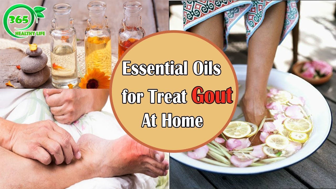 [GOUT TREATMENT] How to Relieve Gout Pain with 4 Essential Oils Recipes