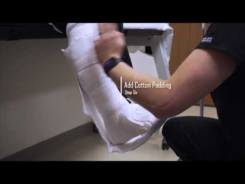 Posterior Short-Leg Splint - Proliance Orthopaedics & Sports Medicine