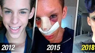 He Spent Millions of Dollars To Become An Alien & This Is What He Looks Like Now... He Spent Millions of Dollars To Become An Alien & This Is What He Looks Like Now...