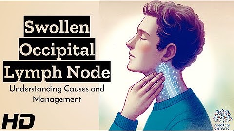 Swollen Occipital Lymph Node: What