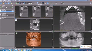 coDiagnostiX Training    2 of 3