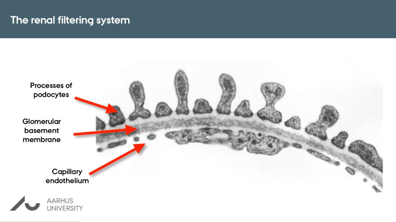 Glomerular Filtration Barrier Renal Medbullets Step 1 vrogue.co