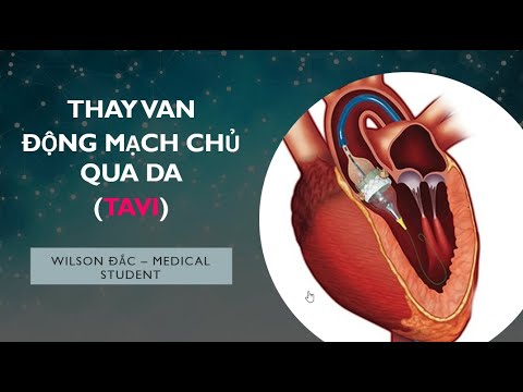 THAY VAN ĐỘNG MẠCH CHỦ QUA DA (TAVI) | MEDTALK EP.3