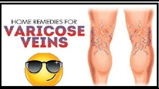 Home Remedies For Varicose Veins