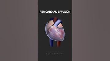 Pericardial Effusion #cardiology #shorts #animation