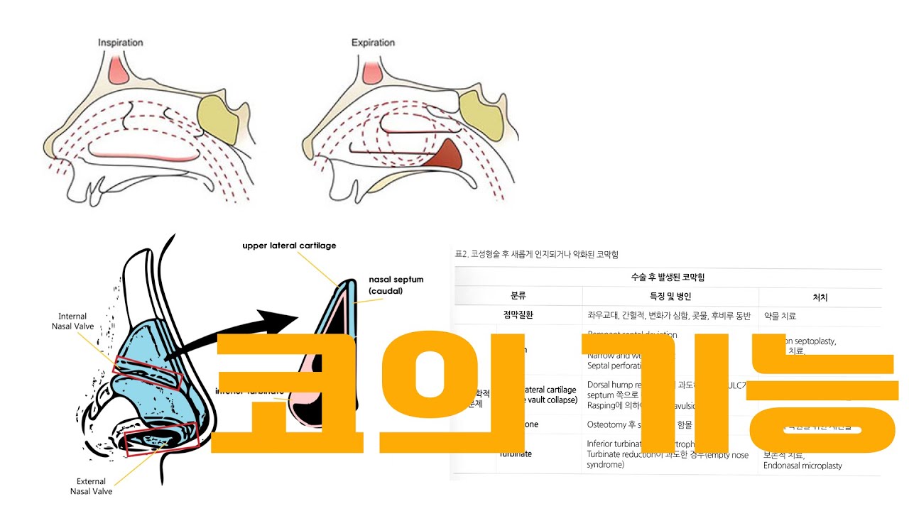 코 구조를 만드는 것이 나에게 미치는 영향은 무엇입니까