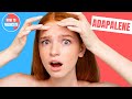 How to use Adapalene? (Differin, Plixda) - Doctor Explains