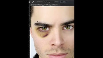 Remove Dark Circles !  🤯😎 #shorts #photoshop