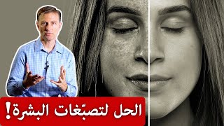 وصفة فعالة للتخلص من تصبغات الوجه وتحت العينين