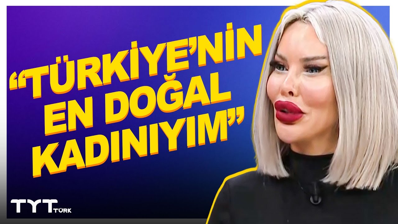 “Türkiye’nin En Doğal Kadınıyım” 250 Estetik Yaptıran Pınar Özkurteller İlk Kez Anlattı